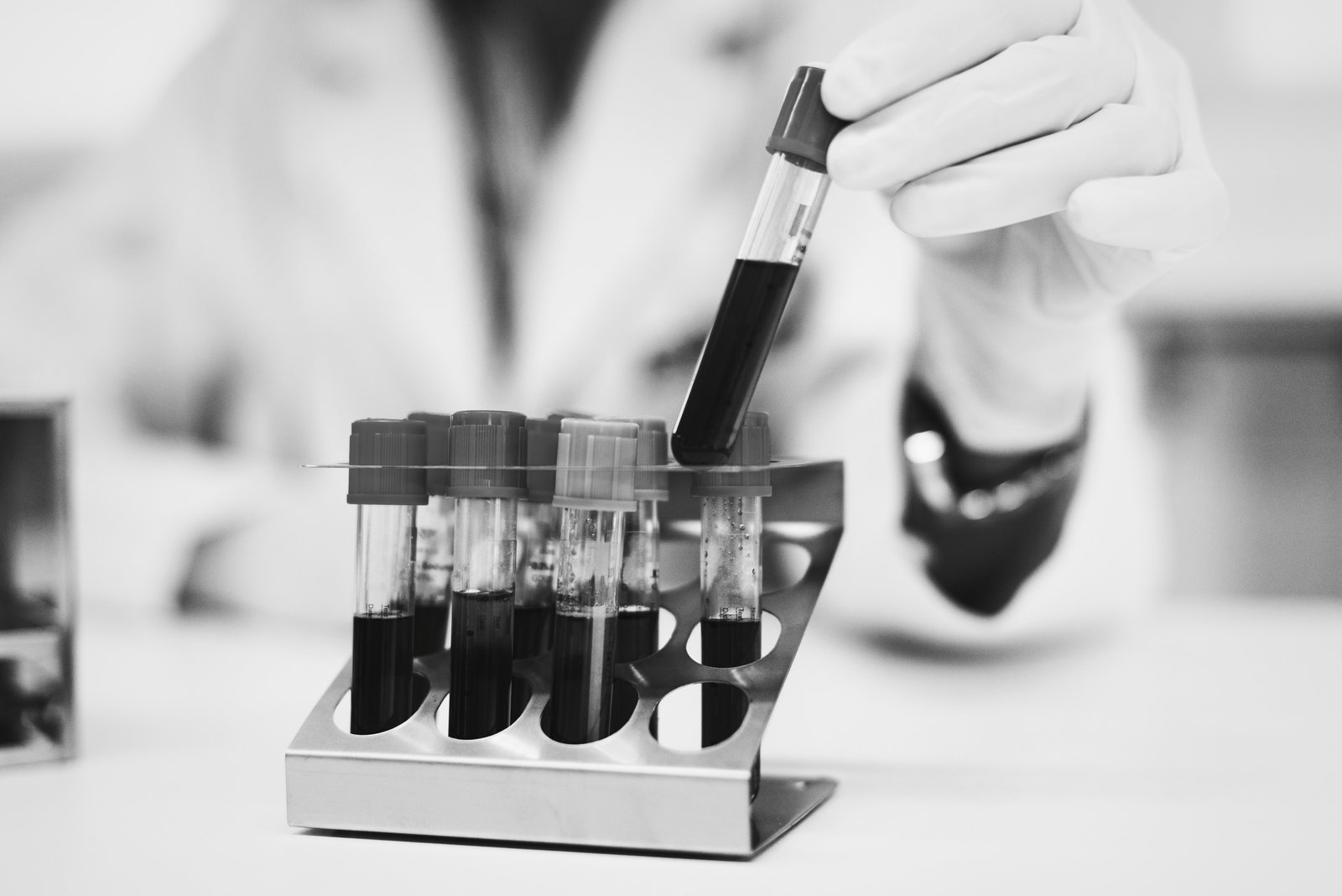 Laboratory Tests